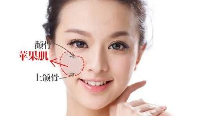 蘋果肌好看還是不好看？女生有蘋果肌好看嗎？