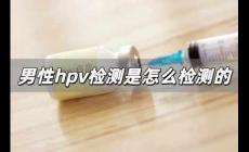 男性hpv檢測(cè)是怎么檢測(cè)的 男性查hpv是抽血嗎